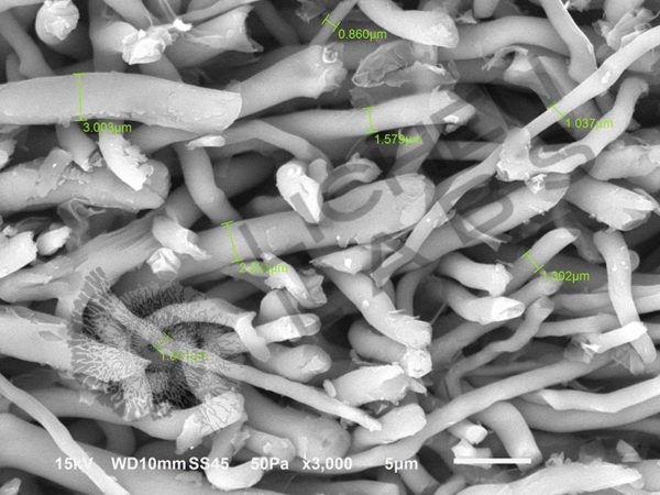 Bracket Fungus - Image 13